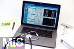30.05.2025, Gesundheitswesen: elektronische Patientenakte auf dem Screen des Apple Laptops.