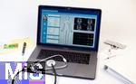 30.05.2025, Gesundheitswesen: elektronische Patientenakte auf dem Screen des Apple Laptops.